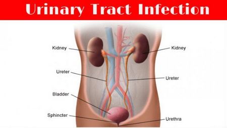 Urinary Tract Infections