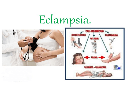 Symptoms of eclampsia patient