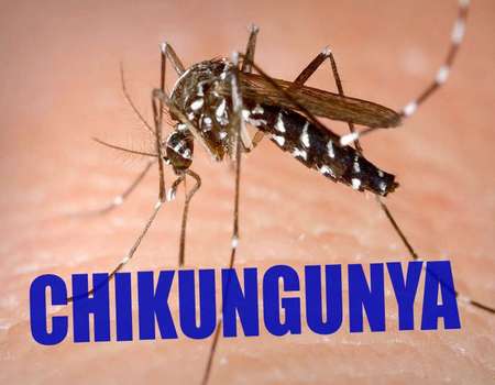 Chikungunya fever