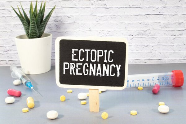 Common sites of ectopic pregnancy