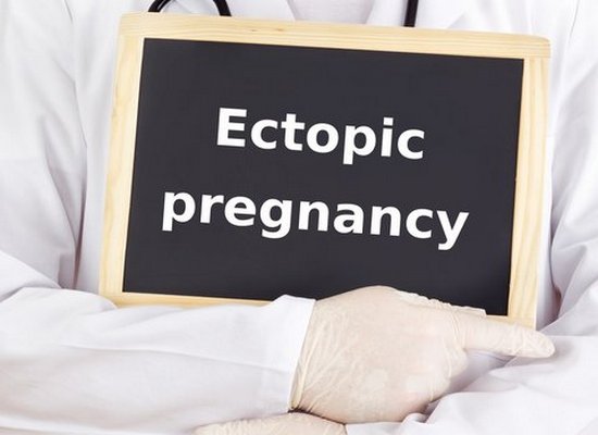 Ectopic pregnancy diagnosis