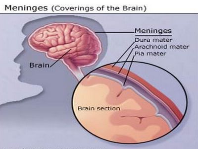 Meningitis disease