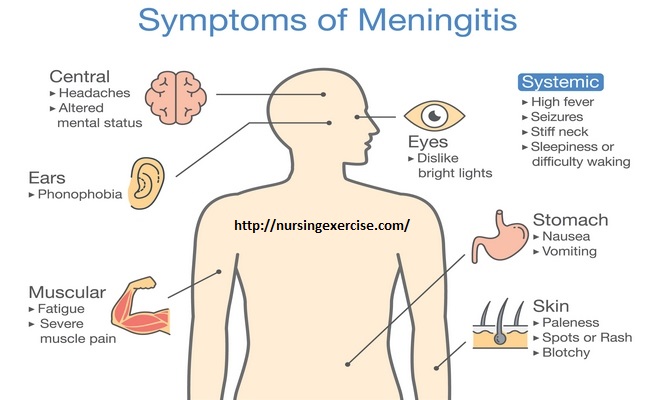 Meningitis sign and symptoms