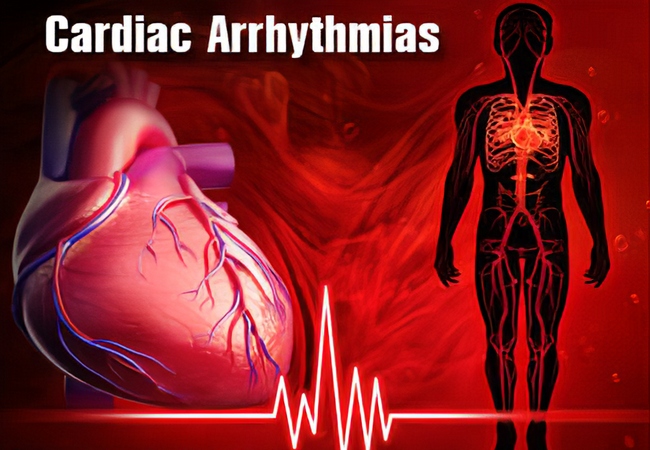 Cardiac arrhythmia patient