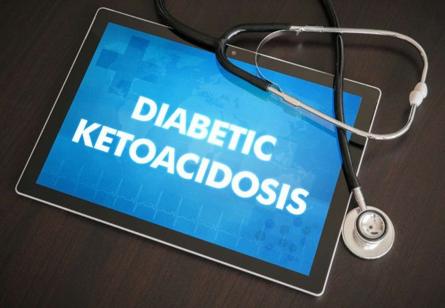 Causes And Management Of Diabetic Ketoacidosis Dka