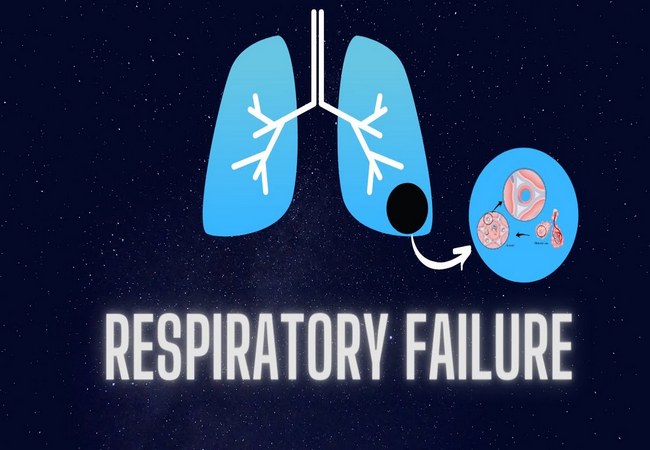 Respiratory Failure