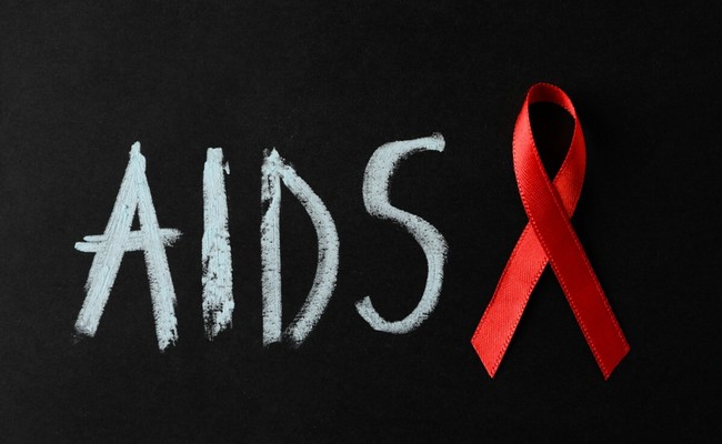 Medical management of AIDS