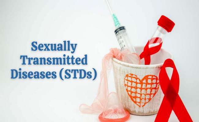 Sexually Transmitted Disease (STDs) Controlling Measures