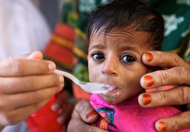 Nutritional problems of children in Bangladesh