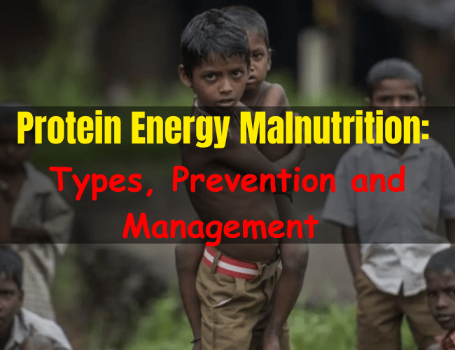 Protein energy malnutrition (PEM) types