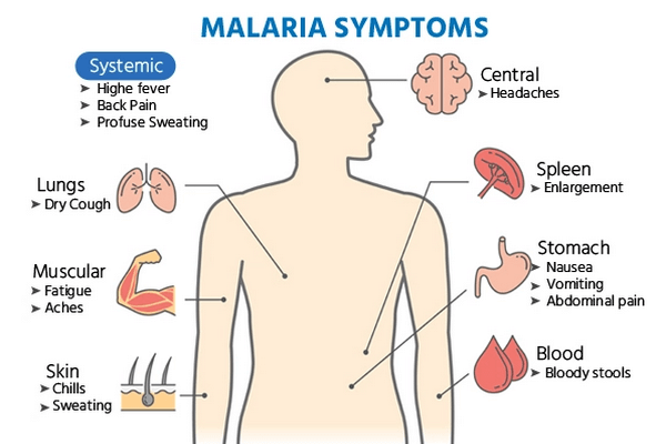 Symptoms of malaria disease